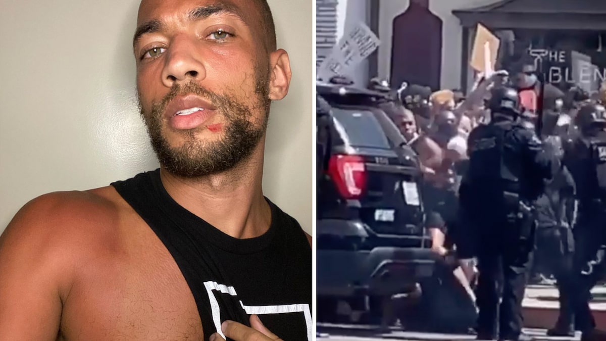 Insecure Star Kendrick Sampson Shot 7 Times With Rubber Bullets During LA Protest