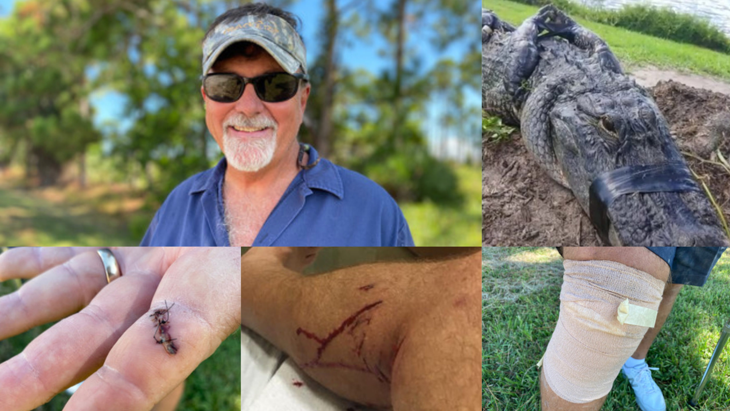 Florida Man Attacked By 8-Foot Alligator While Walking Dog