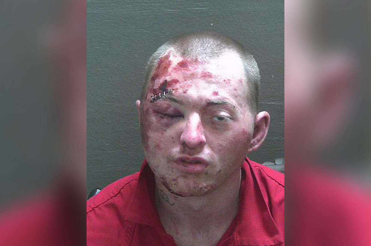 Florida Man Loses Brutal Fight With K-9 During Burglary Arrest