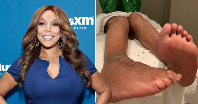 Wendy Williams Show Staff Warned Host About Mean Comments Prior To Posting Feet With Lymphedema