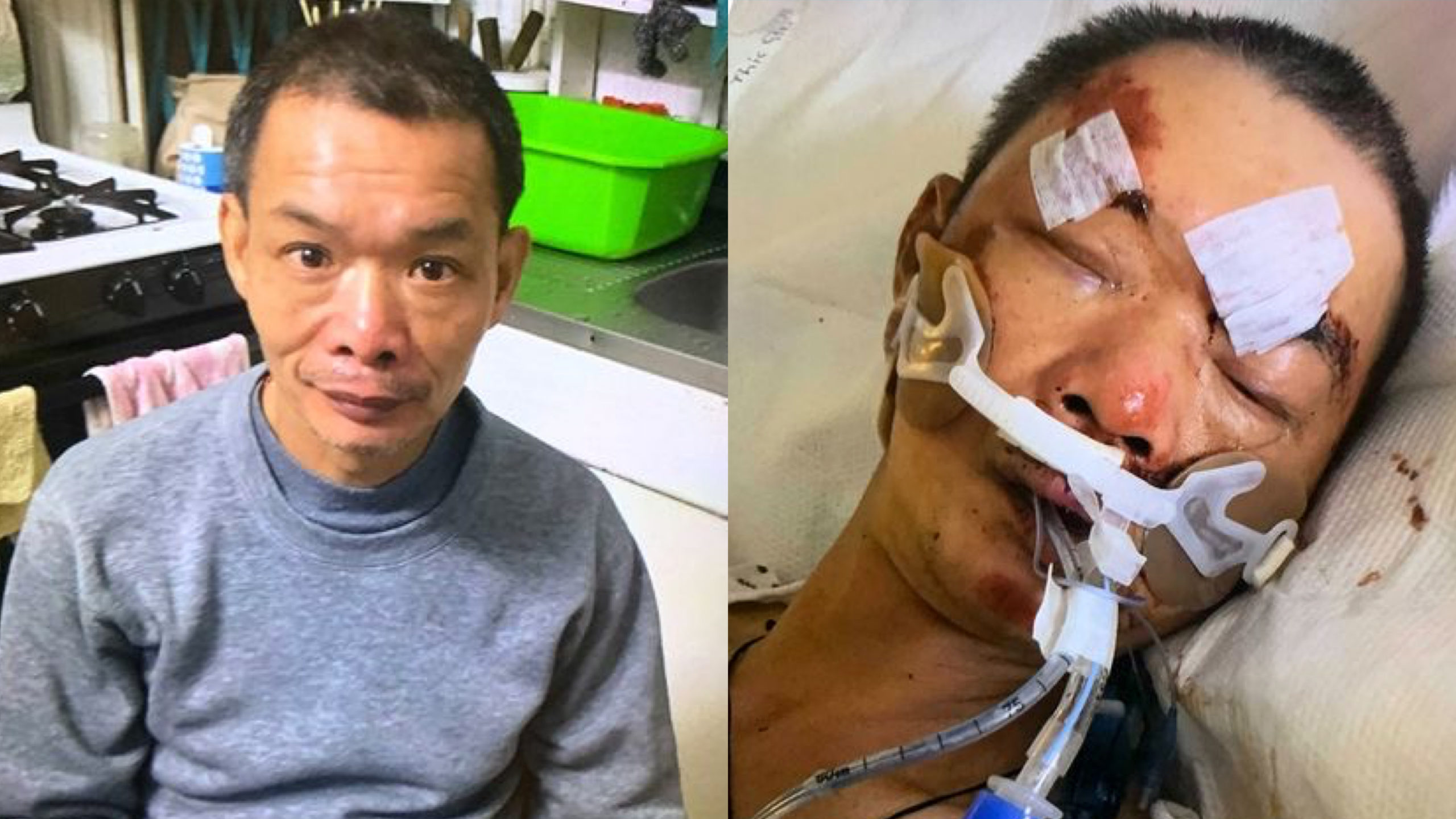 Yao Pan Ma - Asian Immigrant, Who Was Brutally Attacked In Hate Crime Last April, Dies Of His Injuries