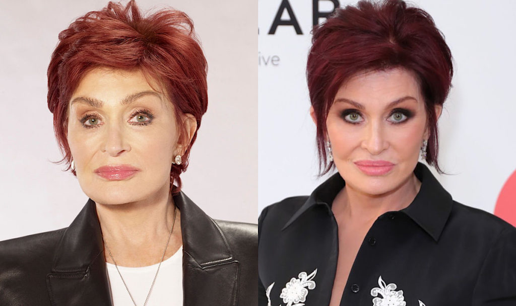 Sharon Osbourne Reveals She Had A 'Horrendous' Face Lift Done Last Year