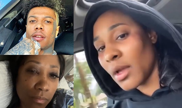 Blueface's Sister Alleges He Punched Her & Their Mother In The Face, Both Women Show Off Their Bruises