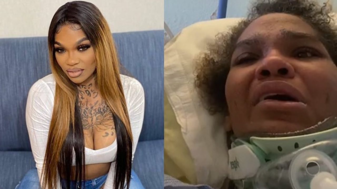 Apple Watts Shows Signs Of Improvement While Recovering From Horrific Car  Crash