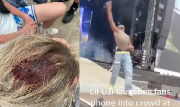 Lil Uzi Vert Allegedly Leaves Woman Bleeding From The Head After Throwing Phone Into Crowd