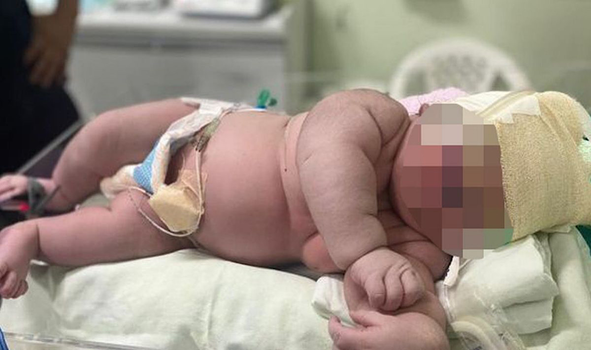 Brazilian Mother Gives Birth To 2-Foot Tall, 16-Pound Baby Boy