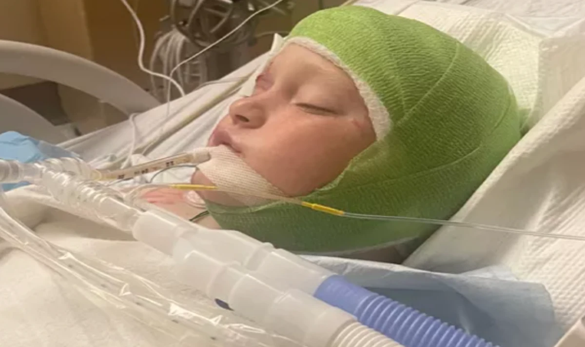 Georgia boy attacked by three pit bulls