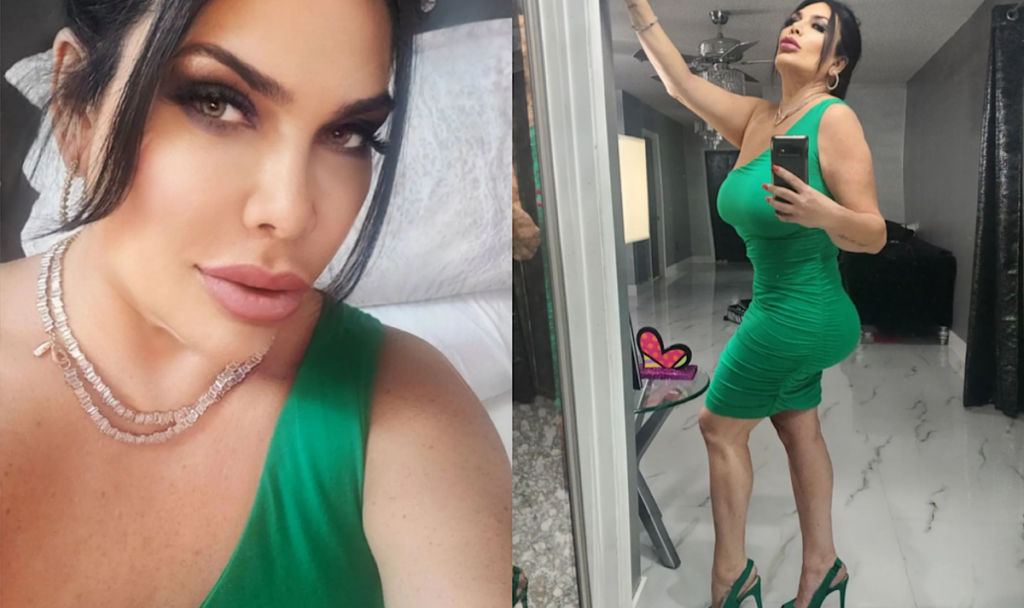 Instagram Model, Whose Breast Implant Burst, Wishes She Never Got