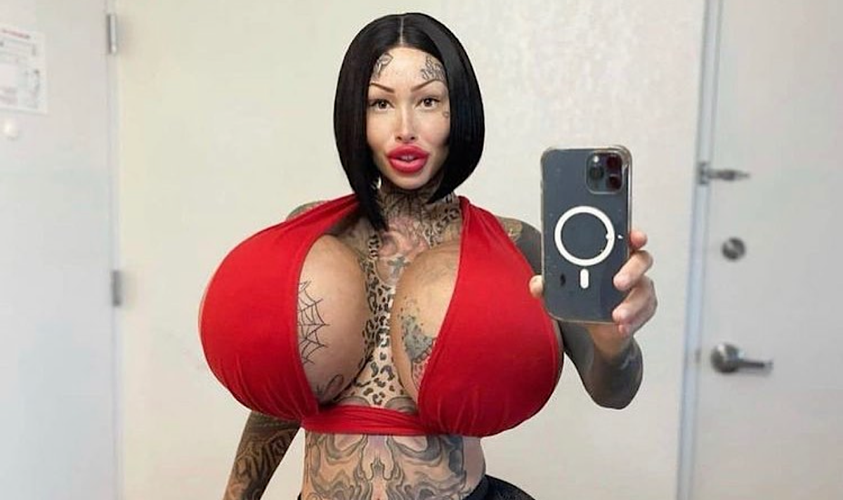 Instagram Model Whose Breast Implant Burst Wishes She Never Got