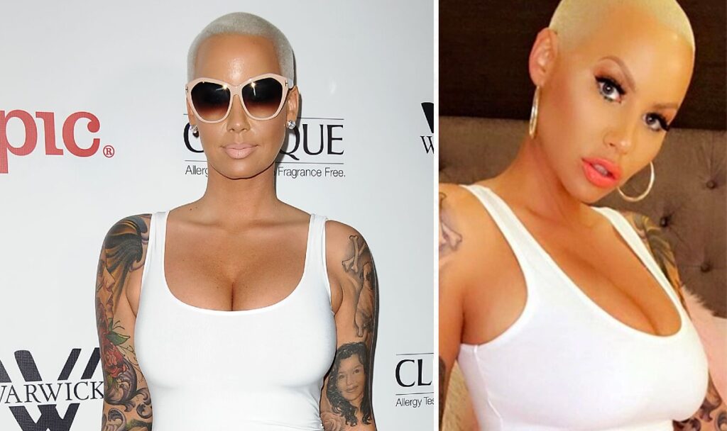Celebrities Who Decided To Reverse Their Cosmetic Work For A More