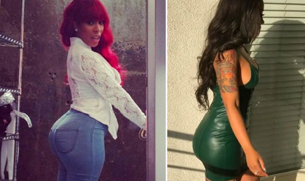 k michelle butt injections