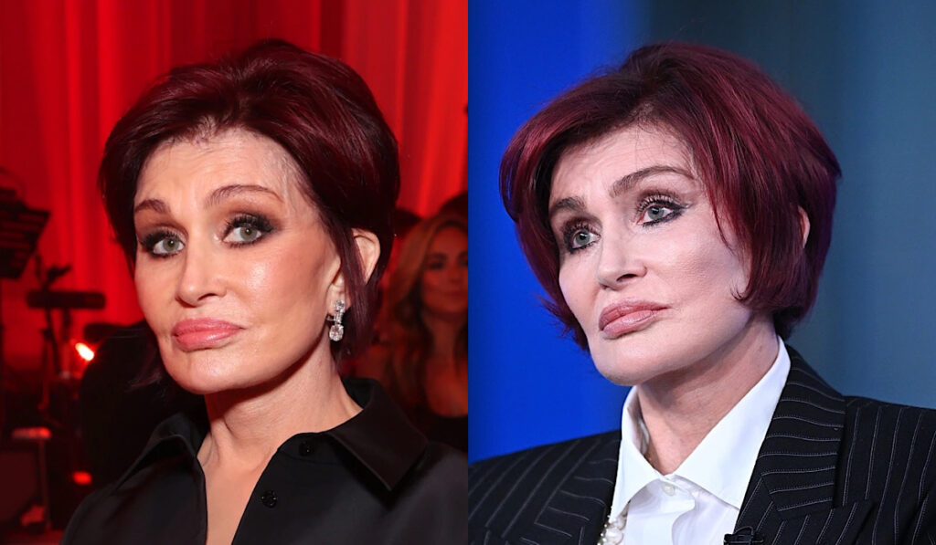 Sharon Osbourne Claims She Is Done With Plastic Surgery: ‘I Really ...