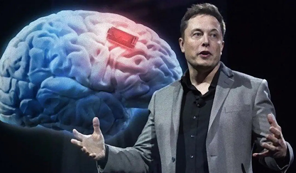 Elon Musk Brain Chip Company Neuralink Says FDA Approved Testing Of