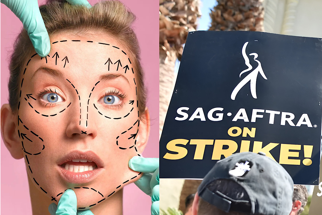 Beverly Hills Plastic Surgeon Claims Business Is Booming As Actors Use Downtime From SAG-AFTRA Strike To Go Under Knife