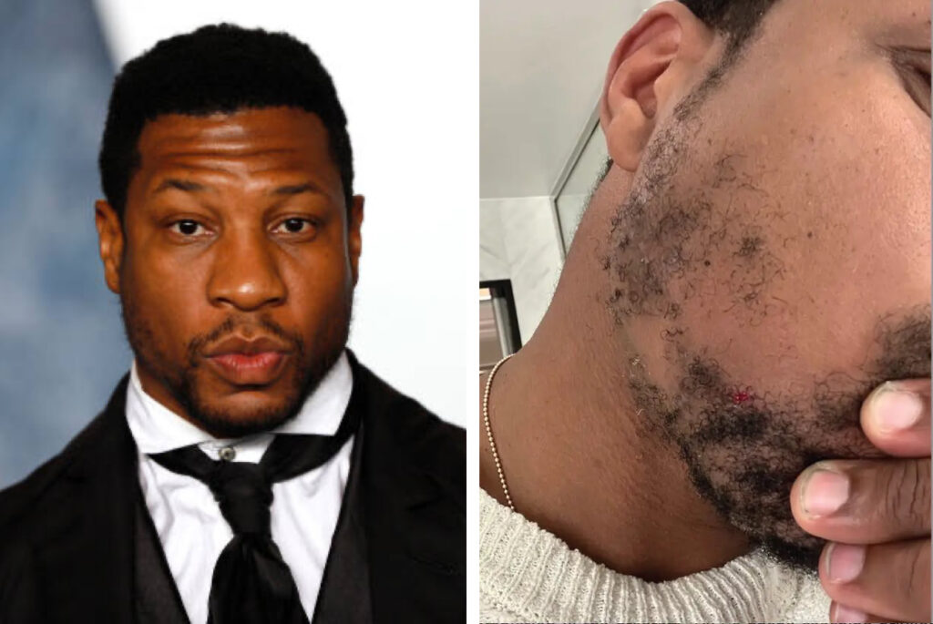 Photos Of Jonathan Majors With Scratches And Ripped Clothing From The Night Of His Alleged Altercation With Ex-Girlfriend Surface