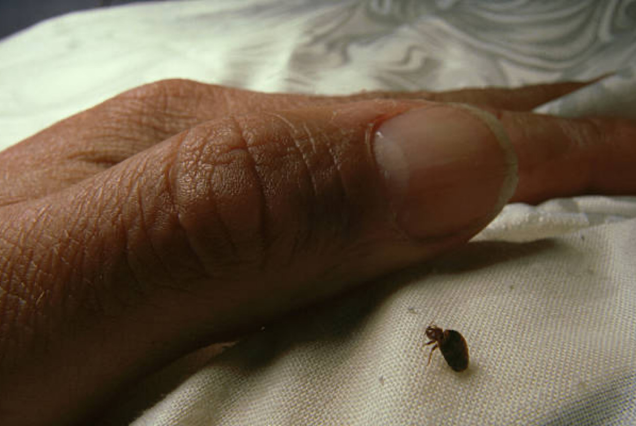 Mayor Of Paris Announces 'No One Is Safe' After Bedbugs Takeover The City