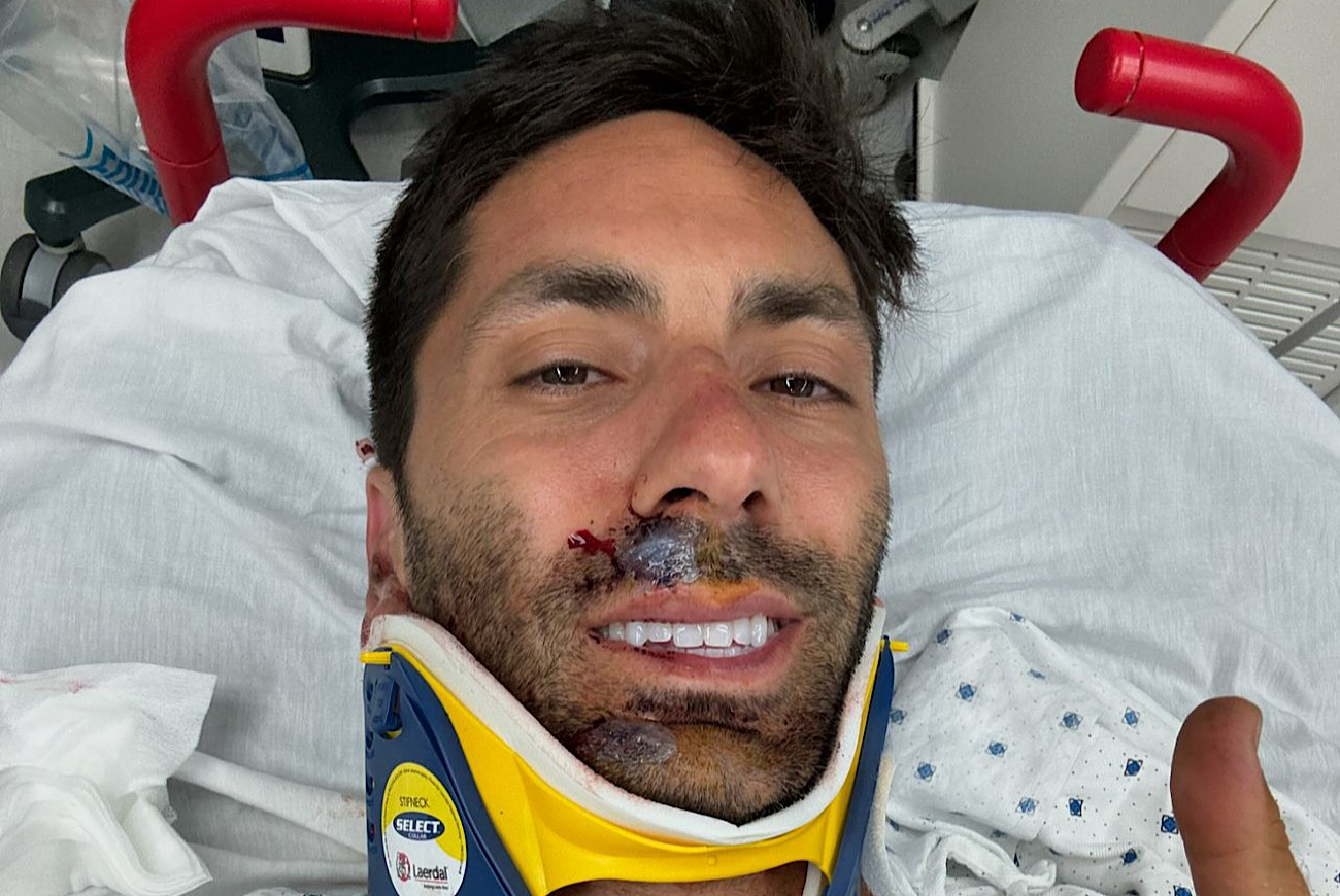 ‘Catfish’ Host Nev Schulman 'Lucky To Be Alive' After Breaking Neck In Biking Accident Involving Truck