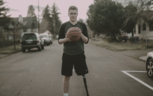 Cancer Survivor's Prosthetic Leg Stolen in Oregon