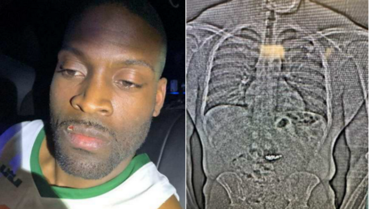 Florida Man Swallows Tiffany Jewelry After $796K Heist, Caught by Police