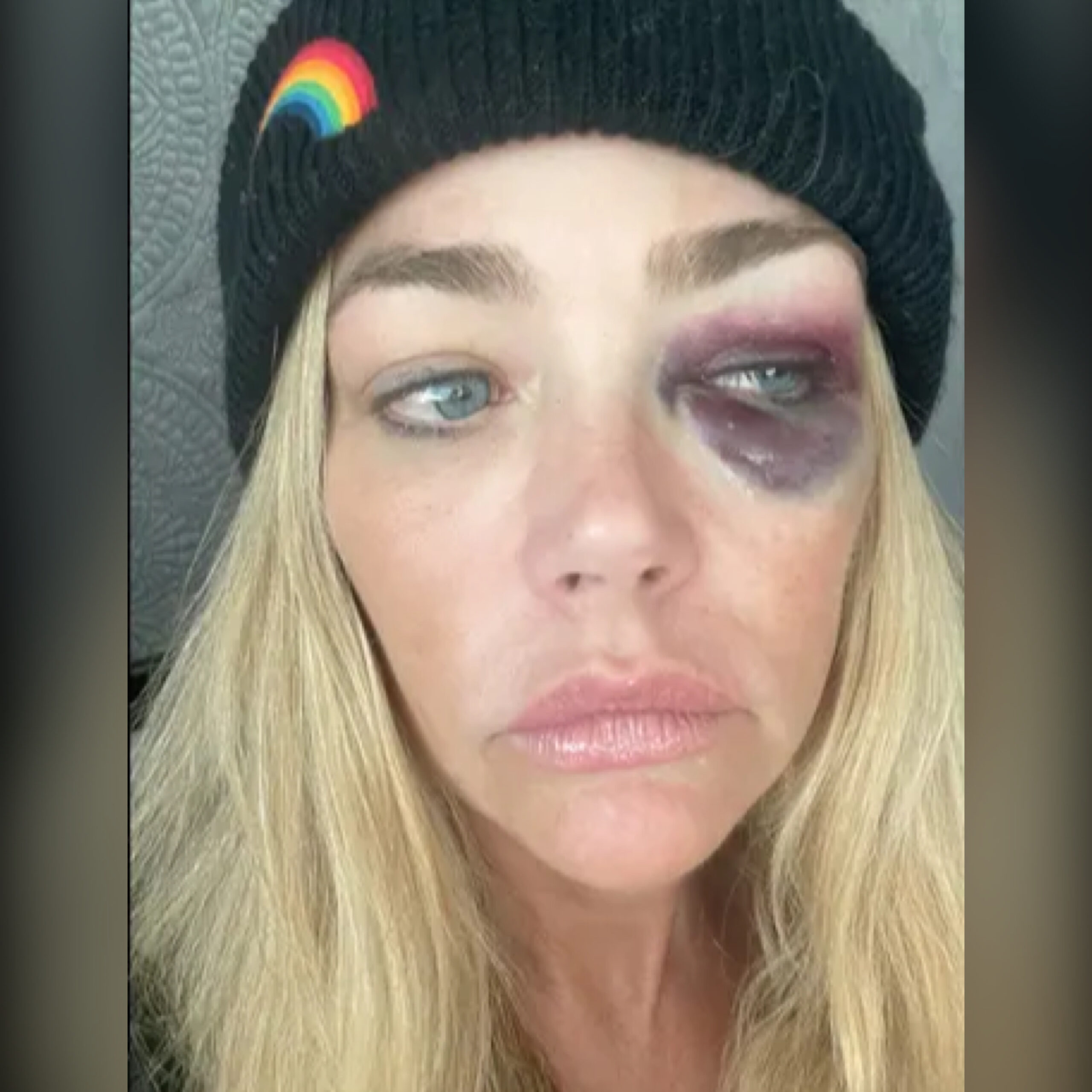 Real Housewives’ Denise Richards Granted Restraining Order Against Husband — Alleges Abuse, Shares Graphic Pics