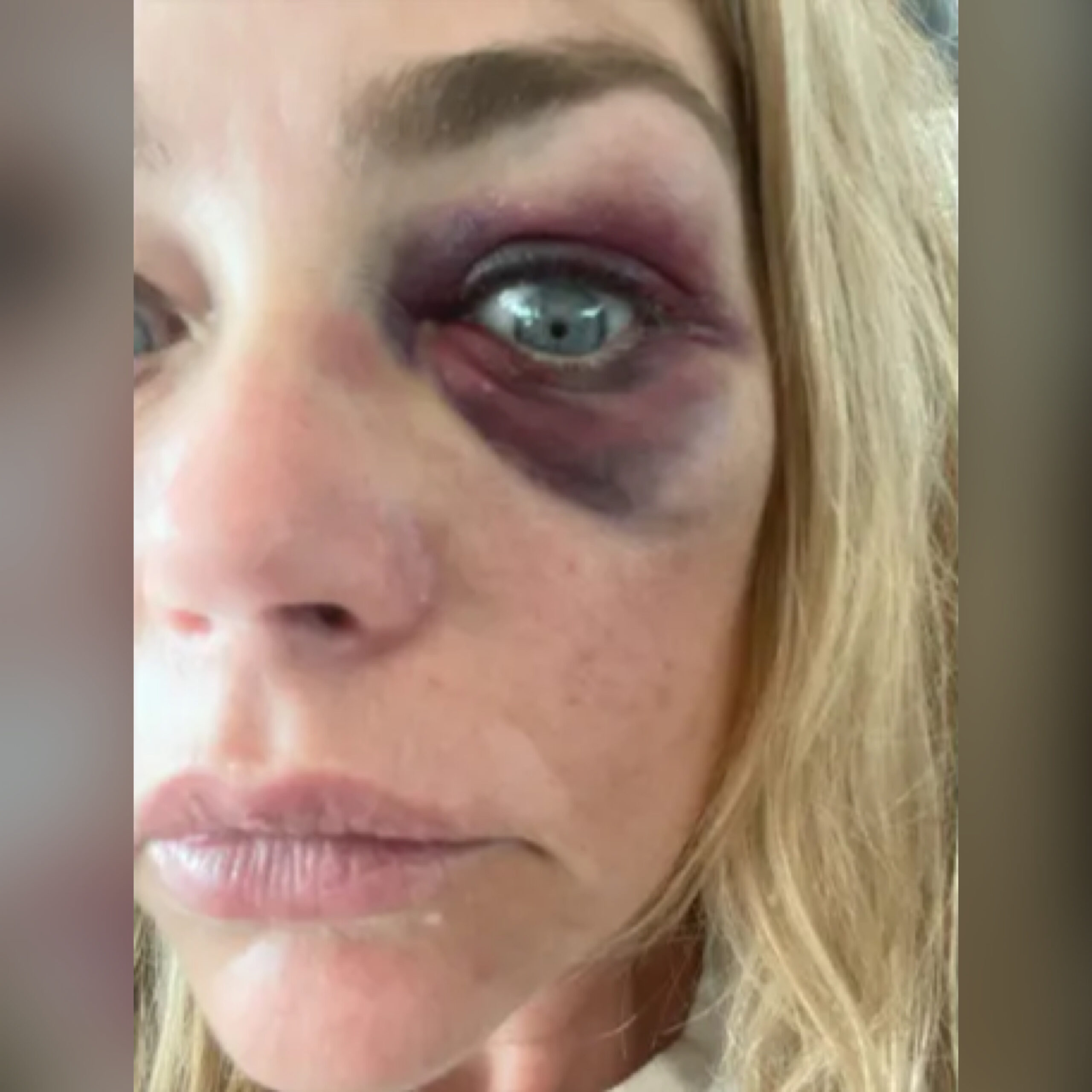 Real Housewives’ Denise Richards Granted Restraining Order Against Husband — Alleges Abuse, Shares Graphic Pics