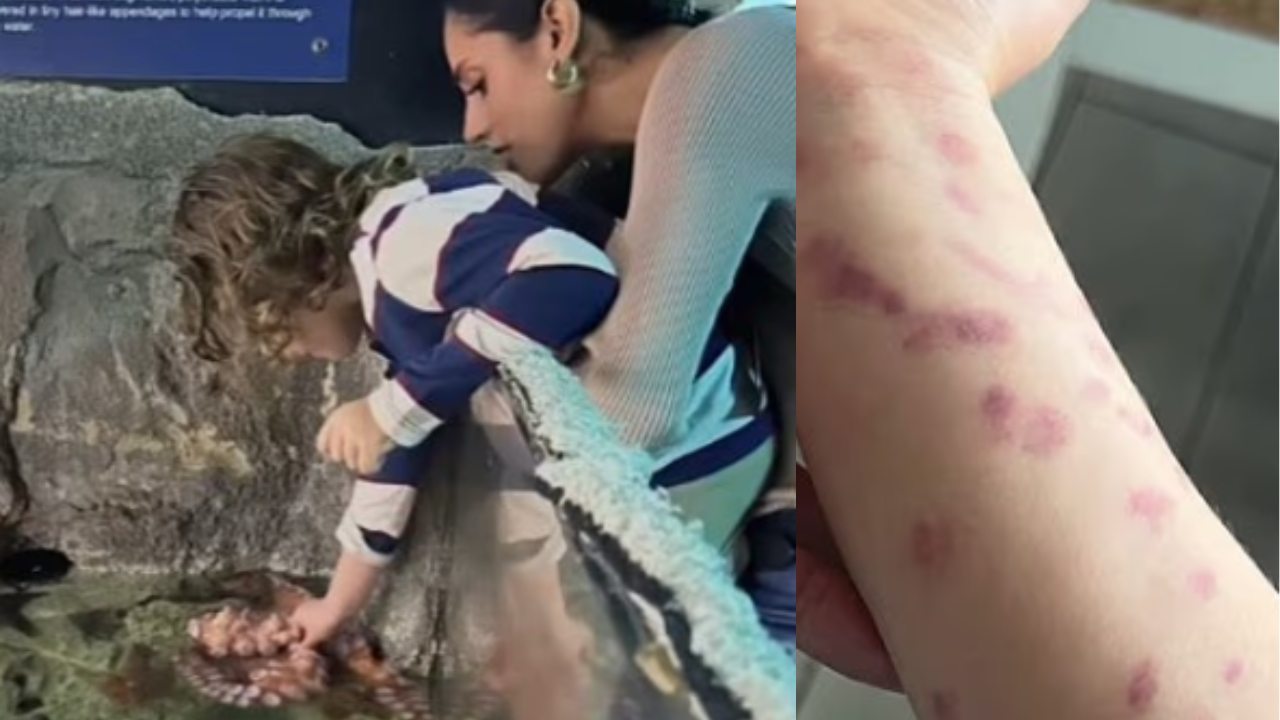 6-Year-Old Boy Attacked by Octopus at San Antonio Aquarium