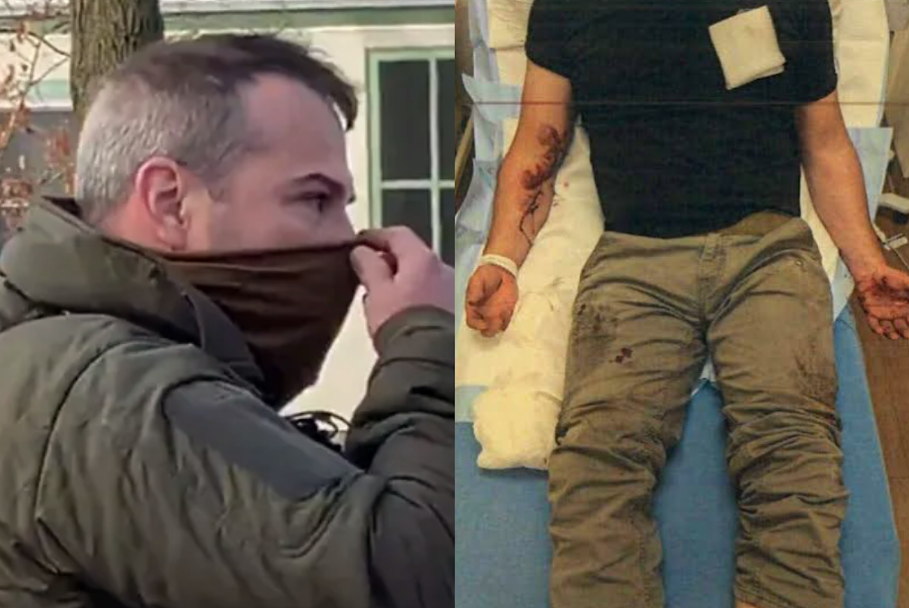 Jonathan Ross Identified As ICE Agent Who Fatally Shot Woman In Minneapolis And Same Officer Who Was Dragged About 100 Yards By Car, Needing 33 Stitches, During Traffic Stop Last Year