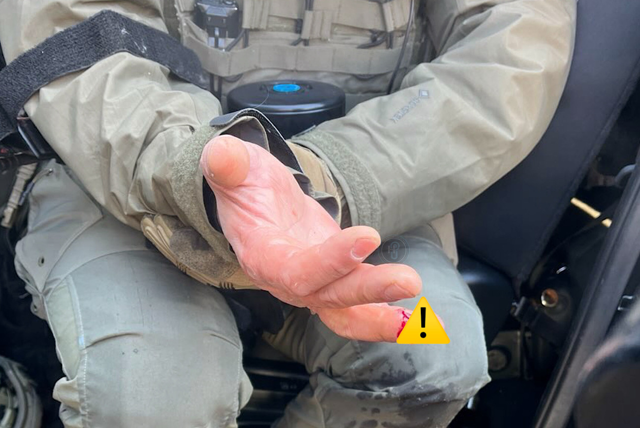 Protestor In Minneapolis Arrested After Allegedly ‘Biting Off Finger’ Of Federal Agent Following Alex Pretti ICE-Related Shooting