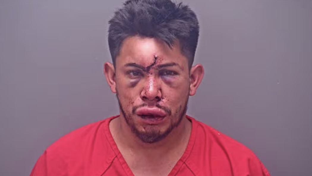 13-Year-Old Allegedly Knocks Father Unconscious After Domestic Dispute in Alabama