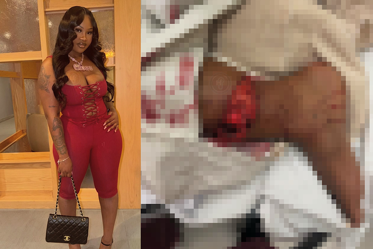 Gloss Up’s Management Thanks Fans For Prayers After She ‘Almost Lost Her Life’ In Serious Car Accident, Graphic Photos Show Severity Of Foot Injury: ‘Amputation Was Very Real Possibility’ 