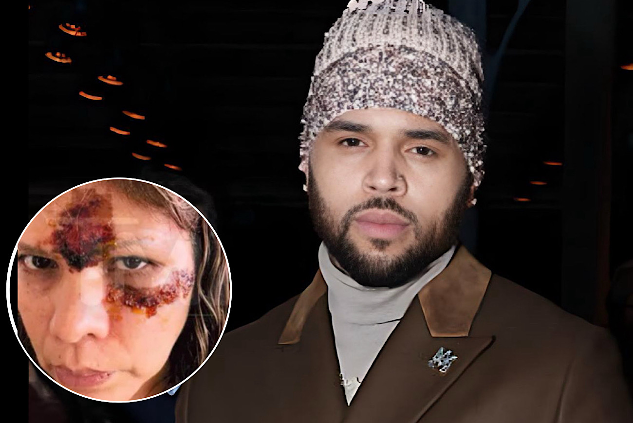 Judge Sides With Chris Brown And Reduces ‘Excessive’ $13M Verdict In Housekeeper Dog Attack Case, She Accepts Reduced $9.5 Million Award
